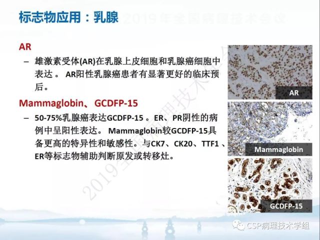 免疫组化检测的临床应用与质量评估