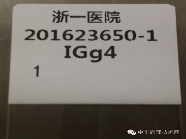 爱华玻片打号机试用报告