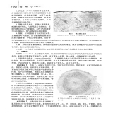 默认相册