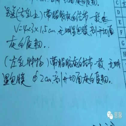 【哼哼哈嘿】分享病例-乳腺增生 孔祥田讲解