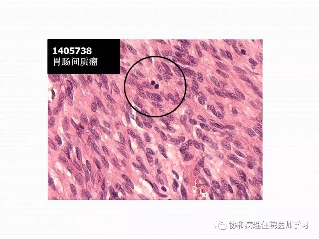 病理学基础知识 : 核分裂像的识别