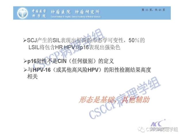 宫颈癌前病变中的诊断难点及阴道镜中ECC的 应用价值