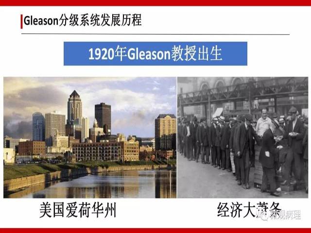前列腺癌Gleason分级系统的前世今生