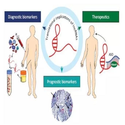 研究 | 被忽略的lncRNA与癌症