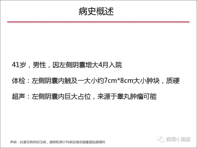 泌尿病理--精原细胞瘤VS精母细胞瘤