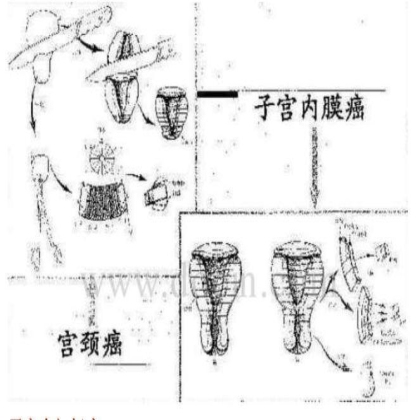 病理标本取材规范