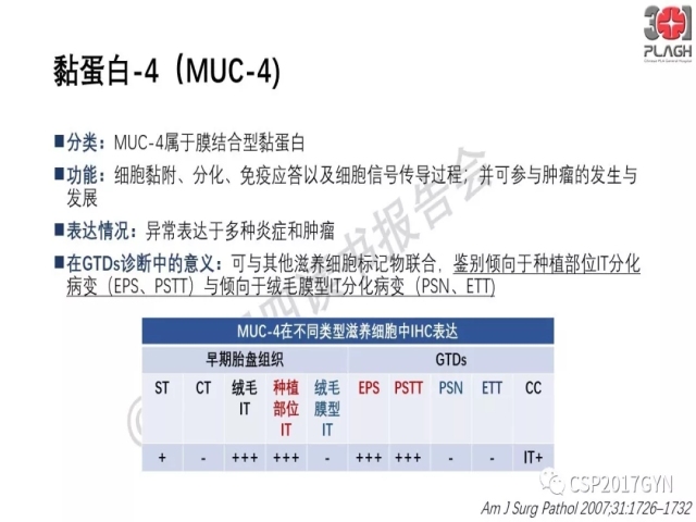 中间型滋养细胞肿瘤的诊断及鉴别诊断