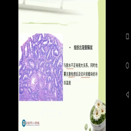 做一张赏心悦目的切片（札记八十六）