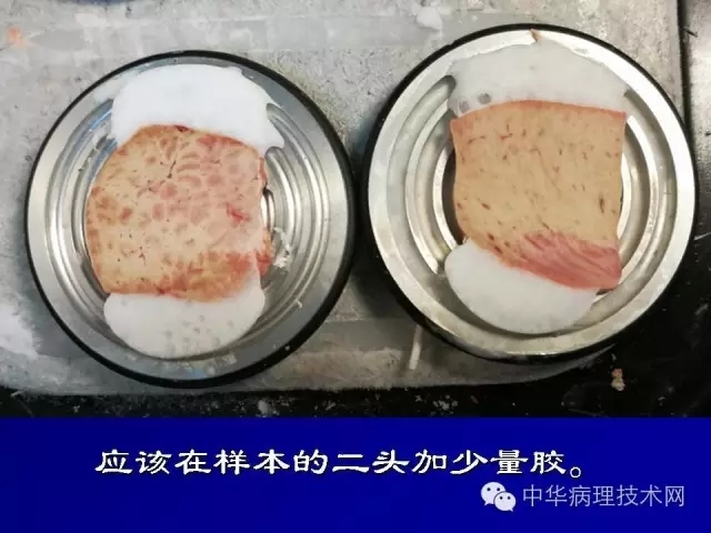 影响冰冻切片质量的原因（比赛注意事项）