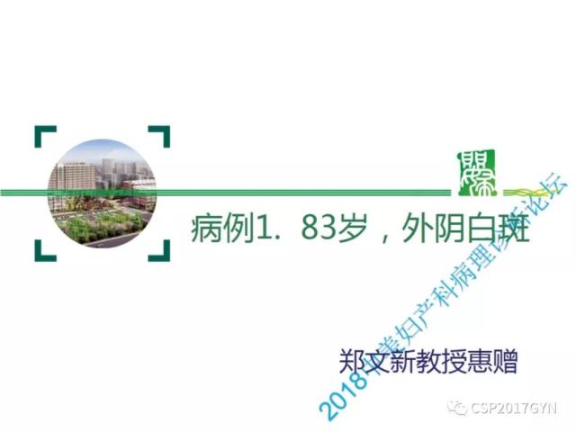 非HPV相关的外阴鳞状细胞肿瘤