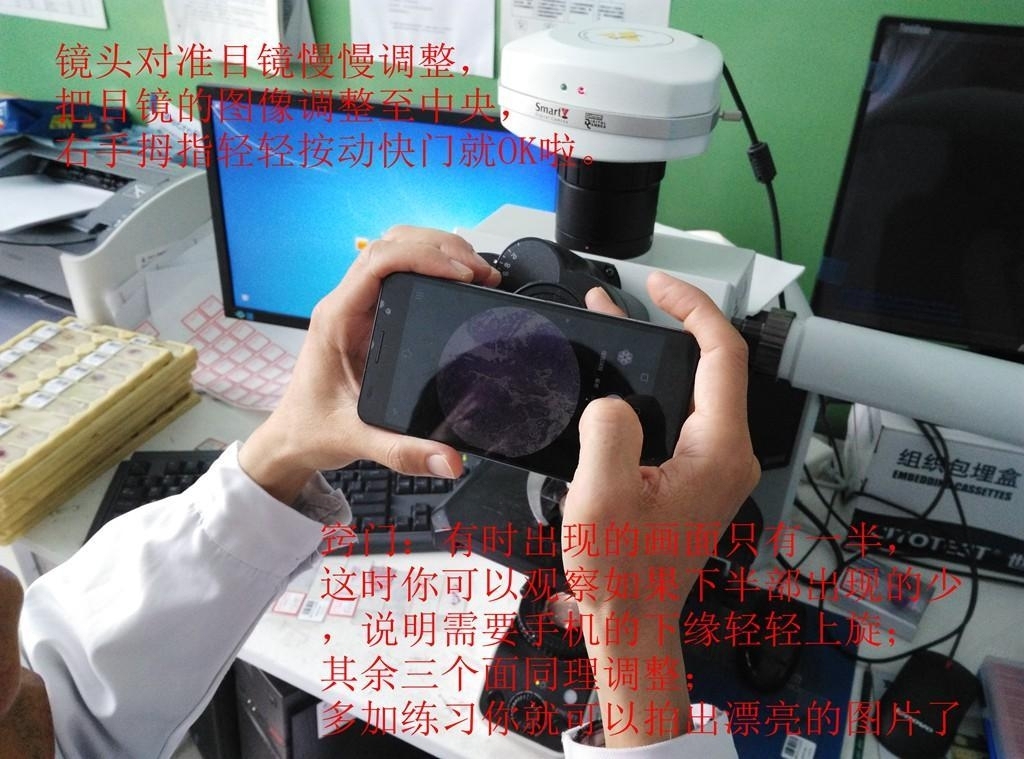如何用手机对目镜拍出漂亮病理图片。