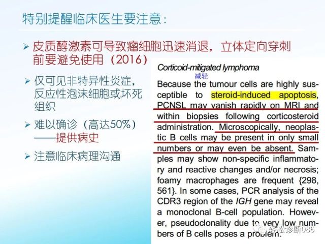 中枢神经系统弥漫大B细胞淋巴瘤