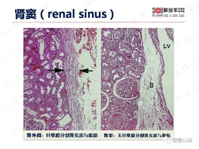 泌尿系统常见肿瘤标本病理报告规范