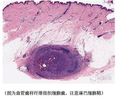 101诊断线索 笔记