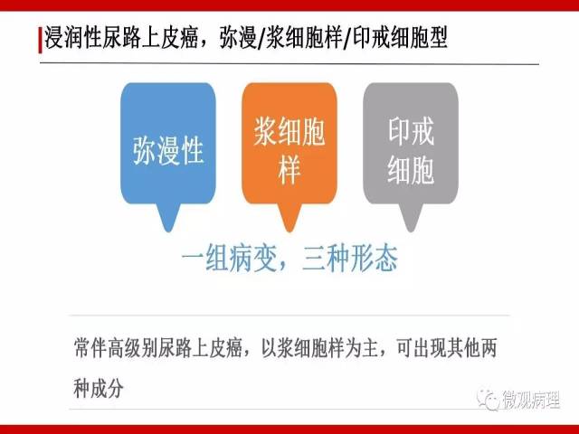 泌尿课程/浸润性尿路上皮癌病理学类型