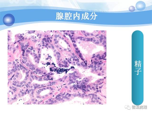 正常前列腺组织学