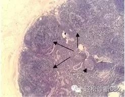 淋巴结T区和髓质组织学