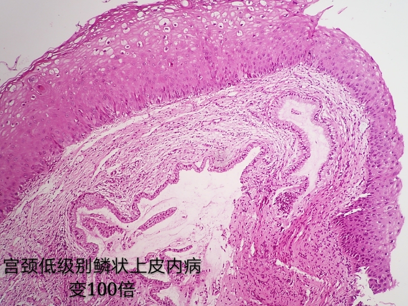 病理科工作札记（三十六）如何用手机拍出满意的组织学照片