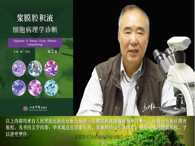 直播预告 | 今晚8点，马博文老师将为大家带来：《浆膜腔 积液细胞病理学诊断》，敬请期待！