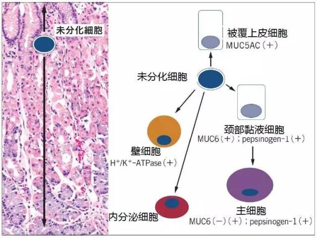 医学美图：胃病理基础概述