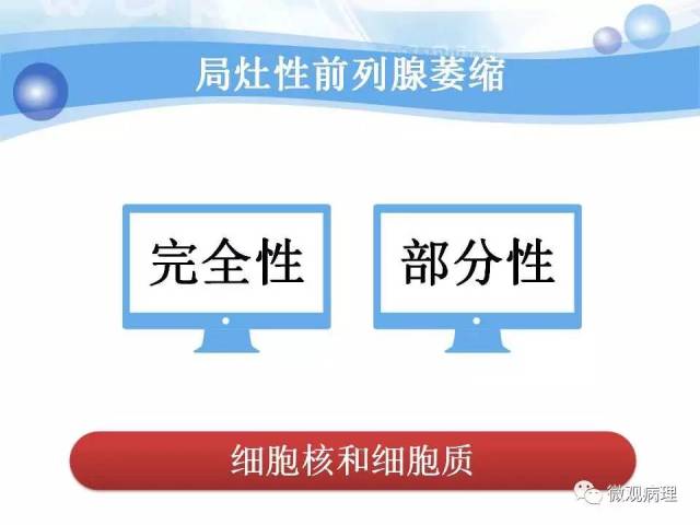 泌尿课程/局灶性前列腺萎缩