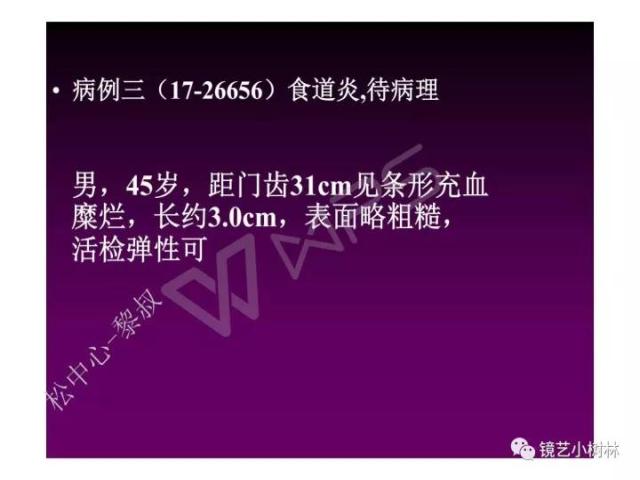 上消化道早癌病理的学习心得体会（附胃牵手癌的病例特点文献学习）