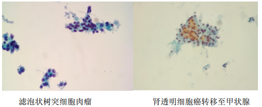 中国医学科学院肿瘤医院进修体会