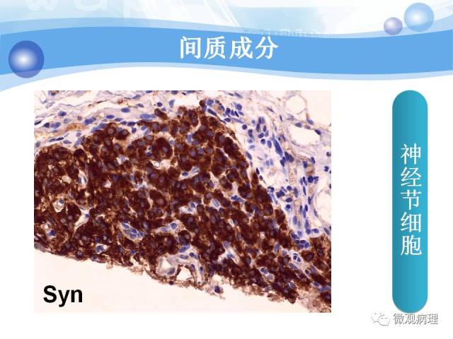 正常前列腺组织学