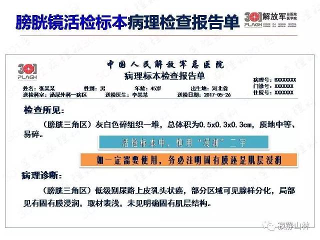 泌尿系统常见肿瘤标本病理报告规范