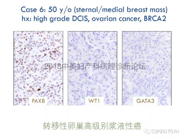 女性生殖道发育