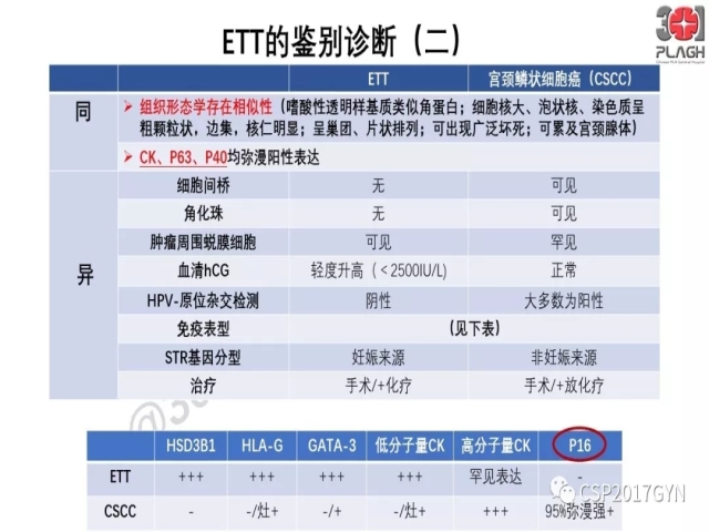 中间型滋养细胞肿瘤的诊断及鉴别诊断