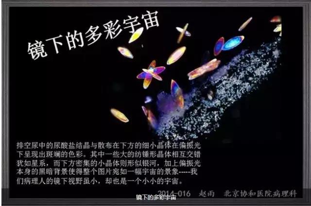 你见过这么美的病理切片吗？