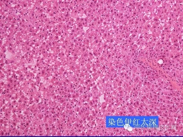 冰冻切片报告注意事项