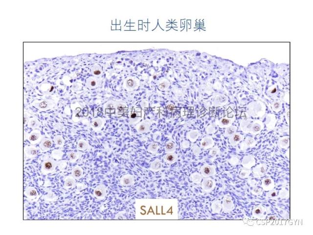 女性生殖道发育