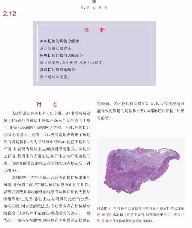 好书推荐 | 术中冰冻切片诊断误区 好书推荐 | 术中冰冻切片诊断误区