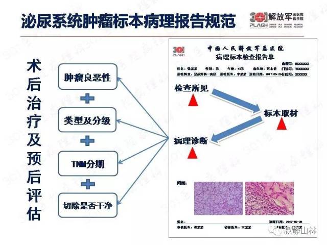 泌尿系统常见肿瘤标本病理报告规范
