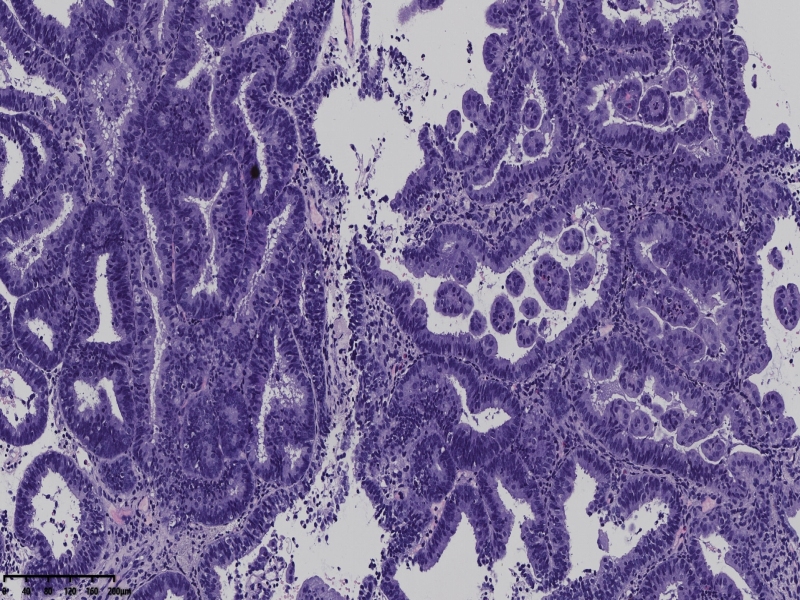 如何消除切片中的裂隙