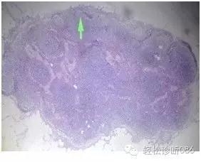 淋巴结T区和髓质组织学