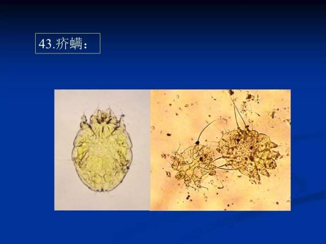 收藏！寄生虫图谱大全