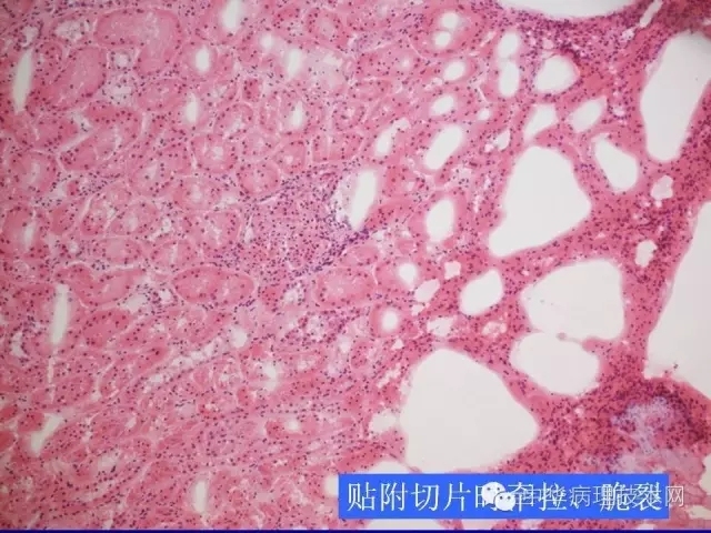 冰冻切片报告注意事项