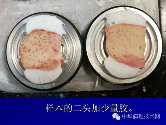 冰冻切片报告注意事项