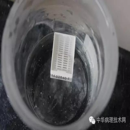 介绍几种日常工作中常见组织的脱钙方法