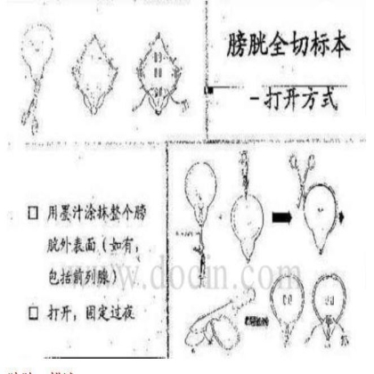 病理标本取材规范