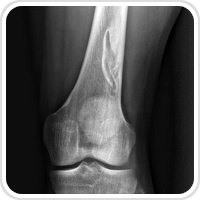 Webpathology.com-镜像翻译（自学使用，版权归原网站所有）