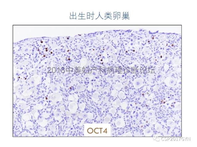 女性生殖道发育