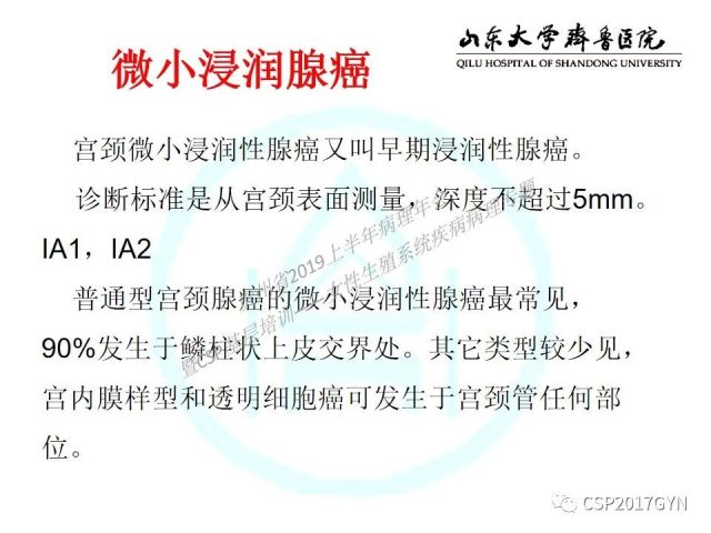 中华病理学会基层培训遵义站讲座（四）——宫颈腺癌的诊断及新分型