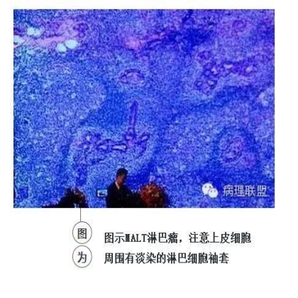 101诊断线索 笔记