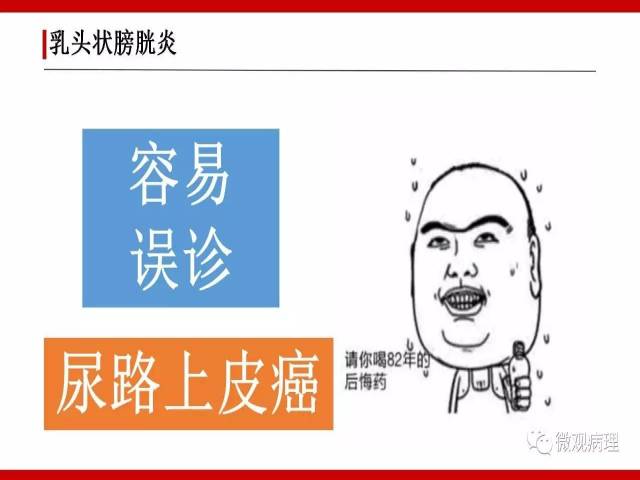 泌尿课程/非浸润性尿路上皮病变诊断的一些困惑