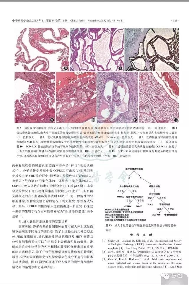 囊性肾瘤（杨倩分享，王哲老师等讲解及讨论）