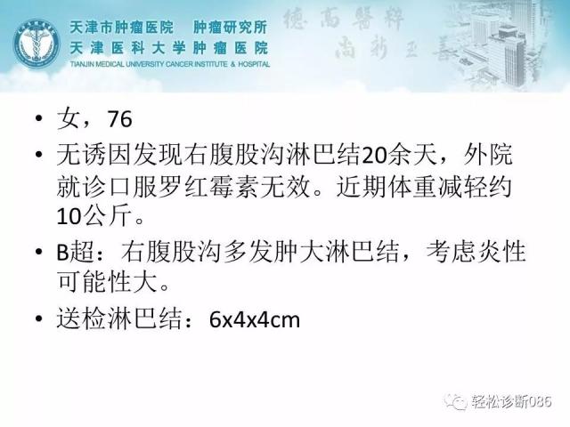 BPDCN病例分享